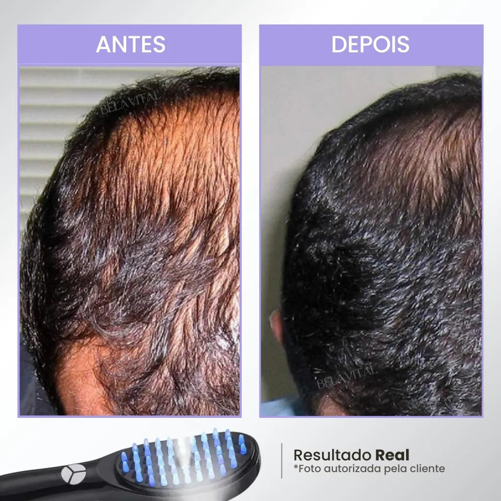 Cepillo para terapia capilar: TheraBrush Smarts 4 en 1