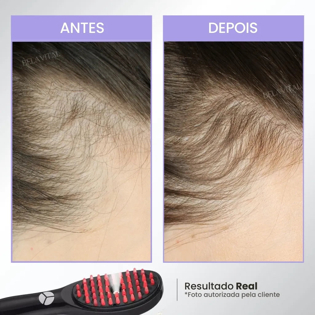 Cepillo para terapia capilar: TheraBrush Smarts 4 en 1